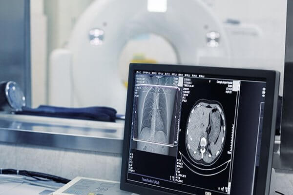 MRI-Gerät, das mit einem Monitor mit Bildern verbunden ist