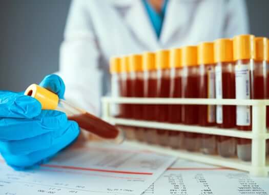 Doctor holding a blood vial in front of a collection of blood vials